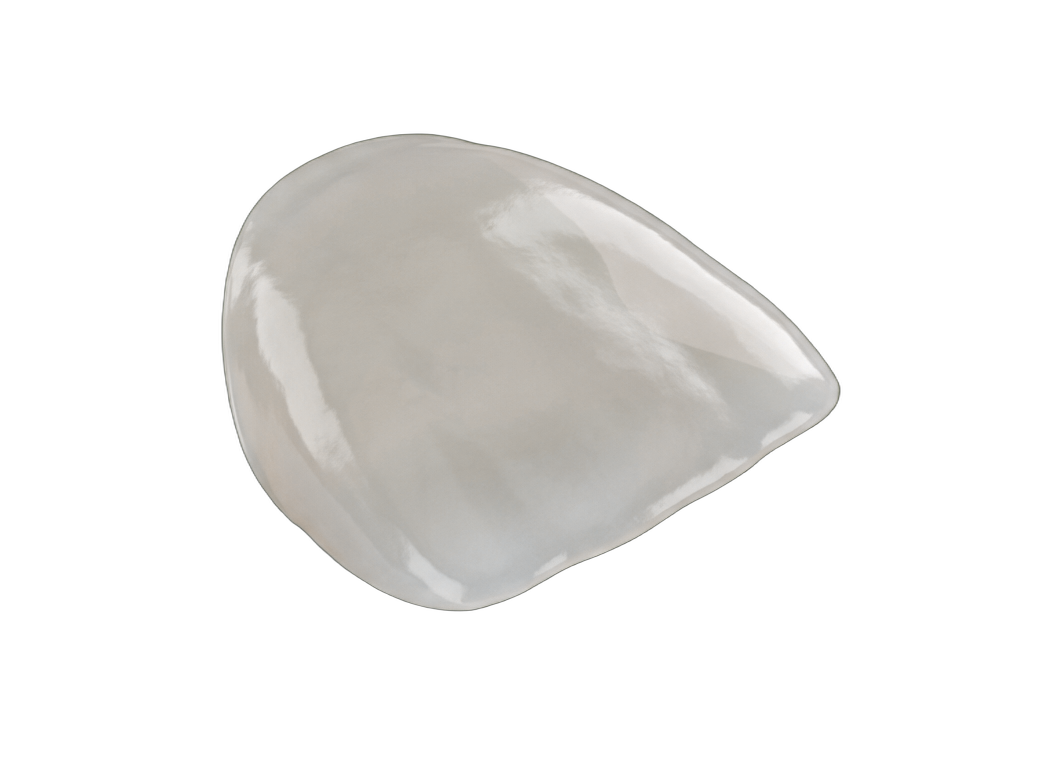 Виниры <strong>на зубы</strong>