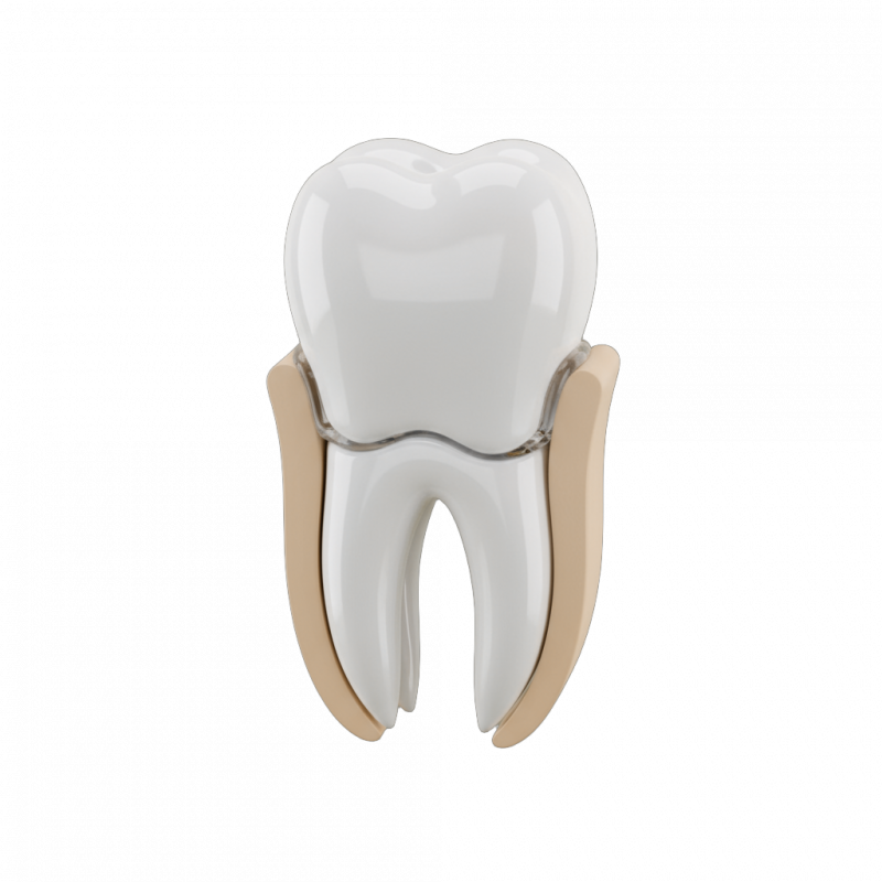 
        Установка <strong>вкладки</strong> на зуб