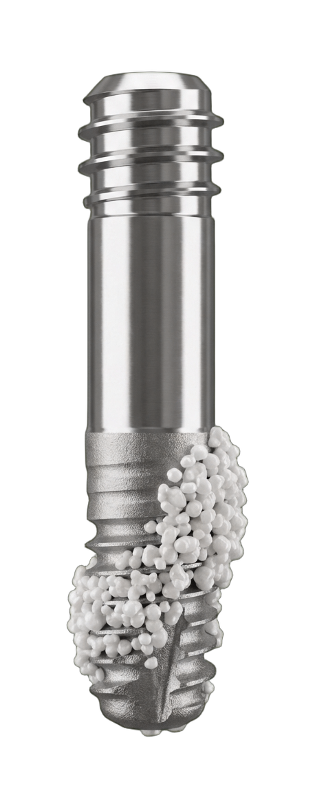 Синус-лифтинг