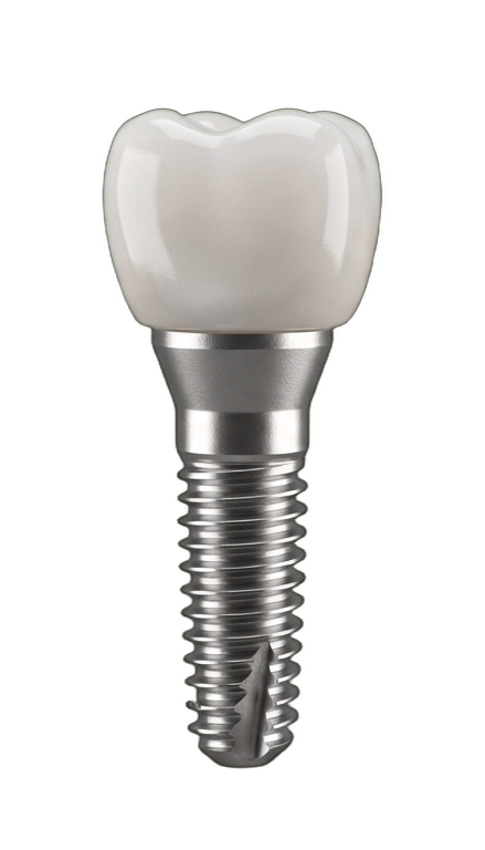 Удаление зуба бесплатно при имплантации