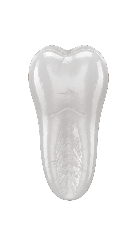 Установка <strong>вкладки</strong> на зуб