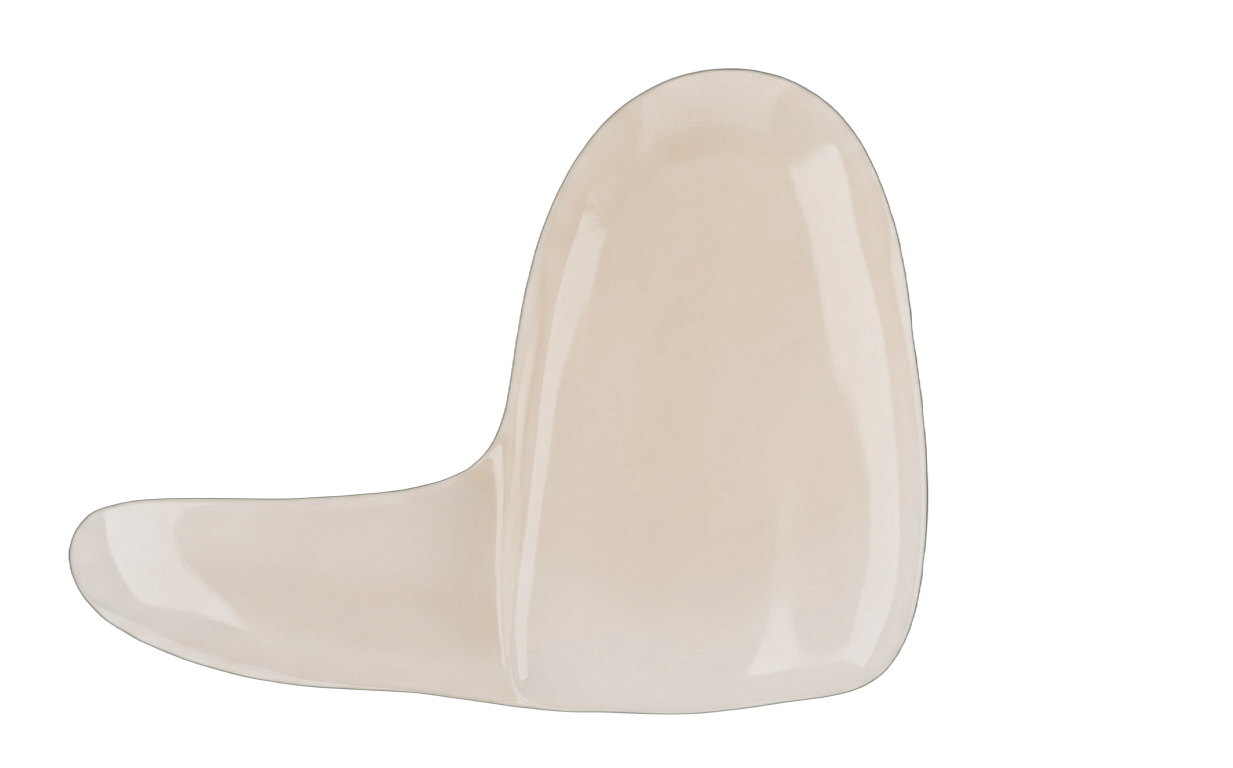 Люминиры <strong>на зубы</strong>