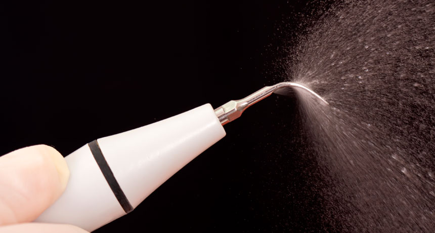 ультразвуковой скалер