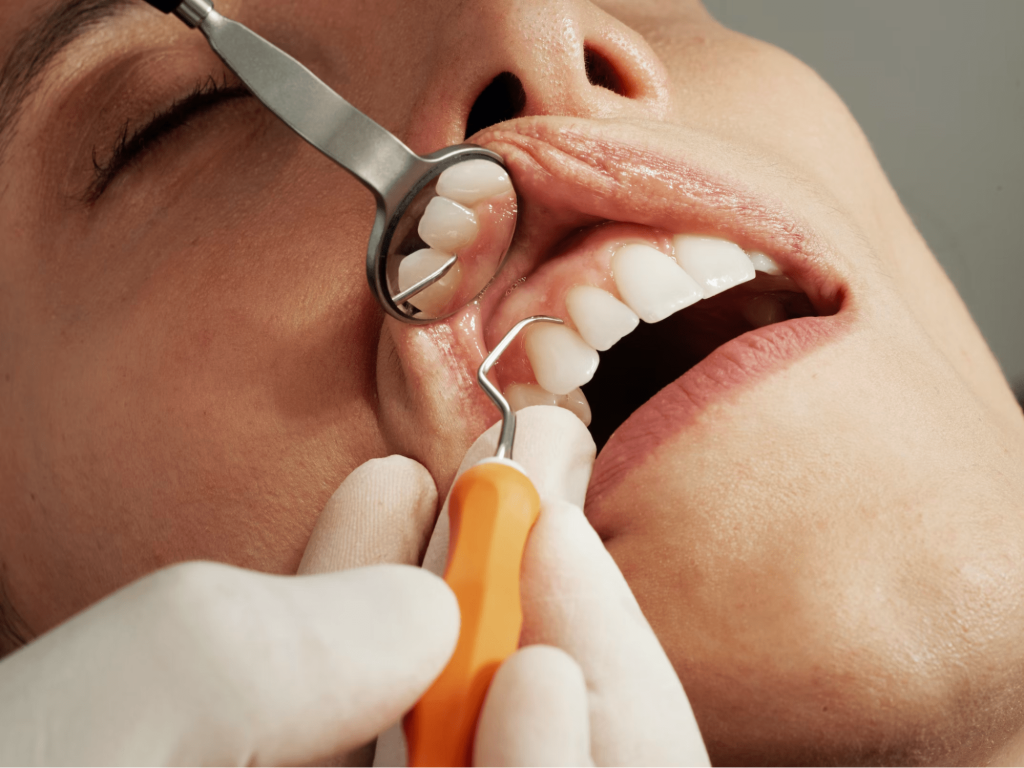 симптомы некариозного поражения зубов