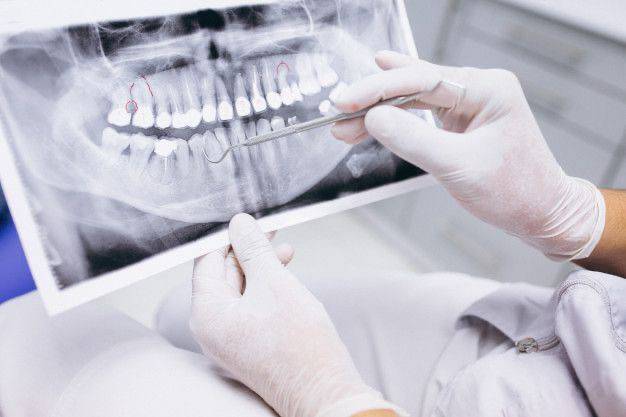 рентгенография зубов